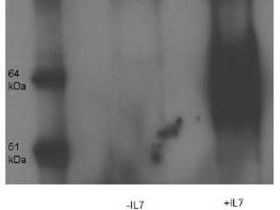 Western Blot: IL-7R alpha/CD127 [p Tyr449] Antibody [NB110-85537]